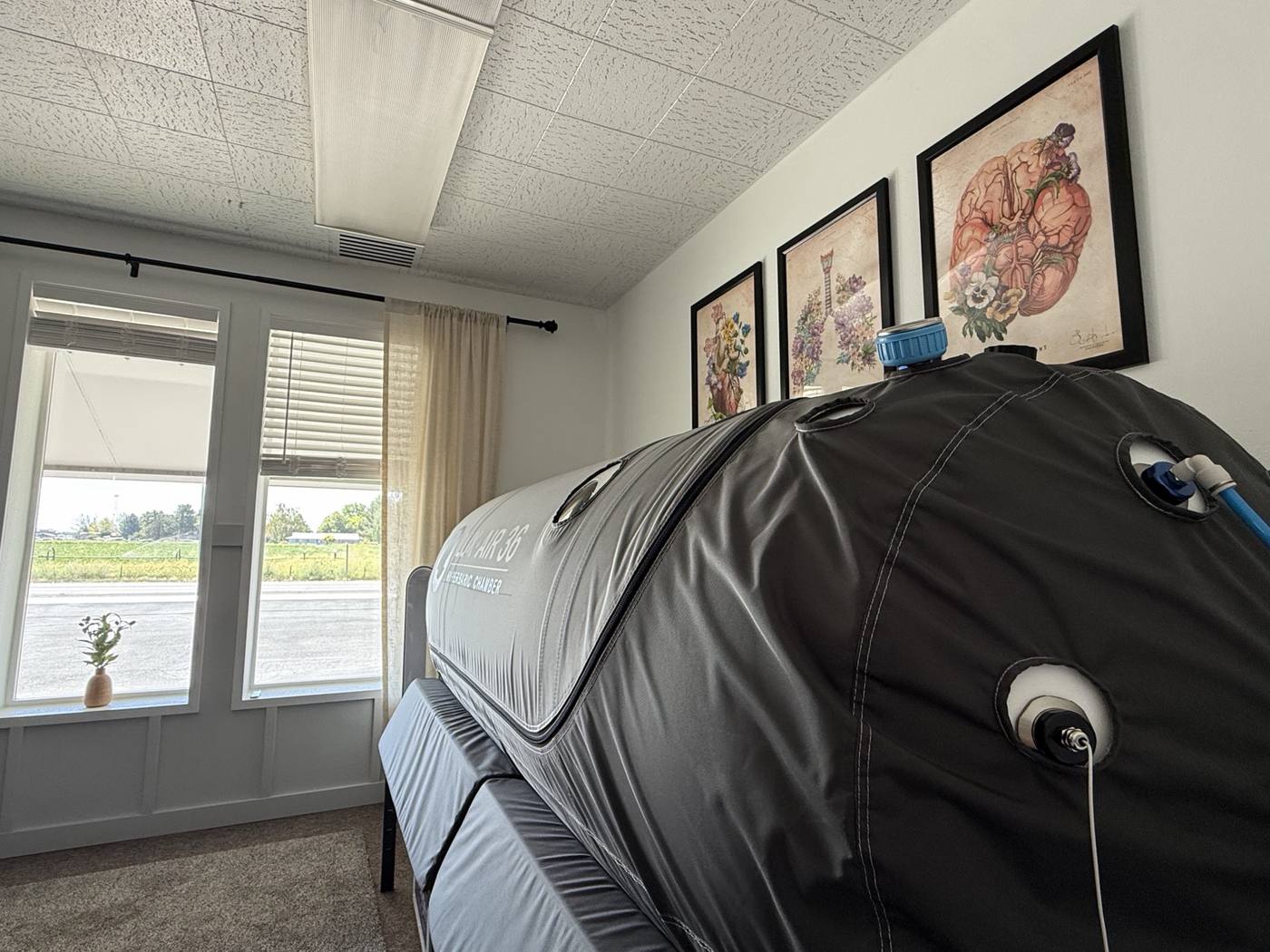 Hyperbaric oxygen chamber in our Jerome treatment room